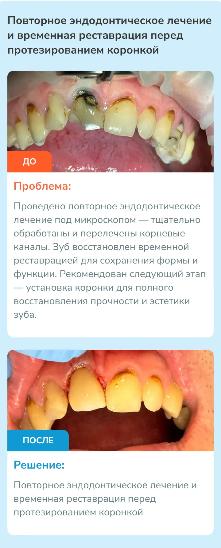 Работа клиники из раздела «Наши работы»: фото зубов до и после лечения, описание проблемы и решения